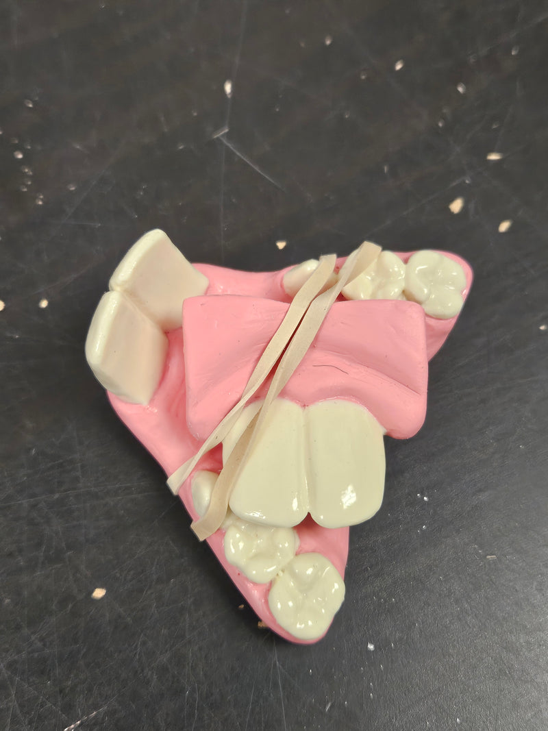 Discounted Item: Jawsets